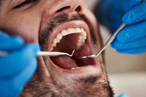 Best Emergency Treatment for Toothache in Monticello, LA
