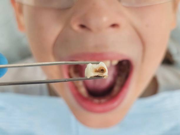 Best Walk-In Emergency Dentist in Monticello, LA